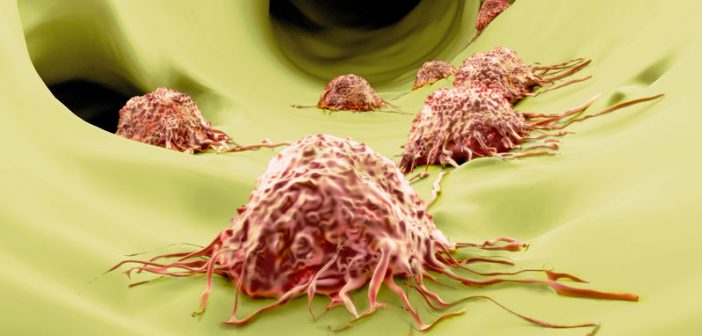 澳银Family|打破Ras癌变细胞不可成药的魔咒，澳银资本领投开悦生命